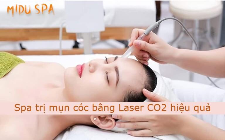 Điều trị mụn cóc tại Midu spa bằng công nghệ Laser CO2