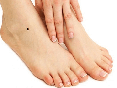 Nốt ruồi ở mu bàn chân là vị trí nốt ruồi không tốt