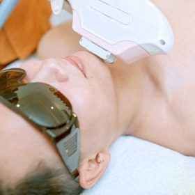 Triệt râu vĩnh viễn cho nam Thủ Đức Quận 9