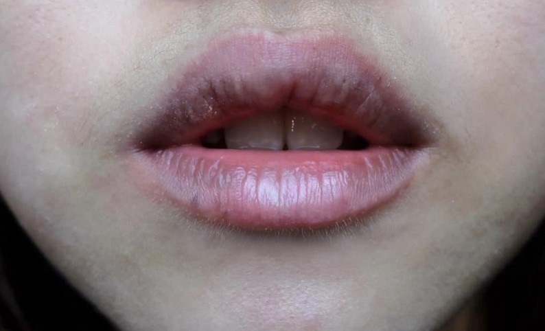 Những dấu hiệu phun môi bị hỏng 