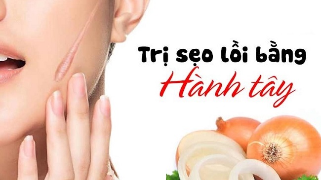 Trị sẹo lồi bằng phương pháp tự nhiên