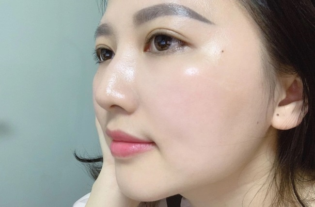 Cấy collagen tươi tại Thủ Đức Quận 9