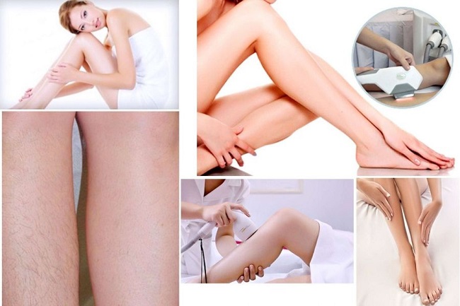 Triệt lông giá học sinh sinh viên Thủ Đức Quận 9