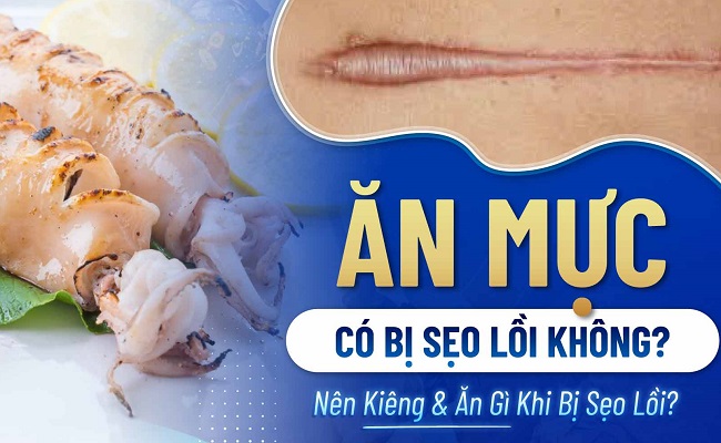 Ăn mực có bị sẹo lồi không?
