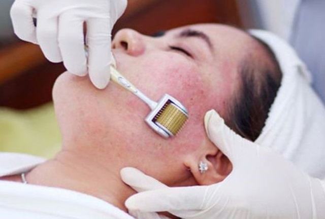 Thải độc da nhiễm corticoid Thủ Đức Quận 9