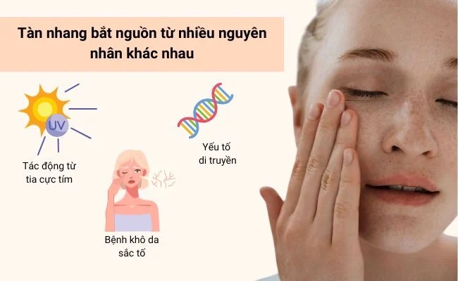 Trị tàn nhang bằng laser Quận 3 Quận 4 Quận 5