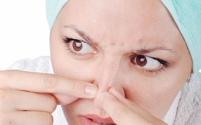 Trị mụn cám Quận 3 Quận 4 Quận 5