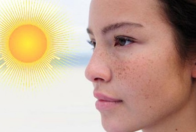 Nám da tuổi trung niên