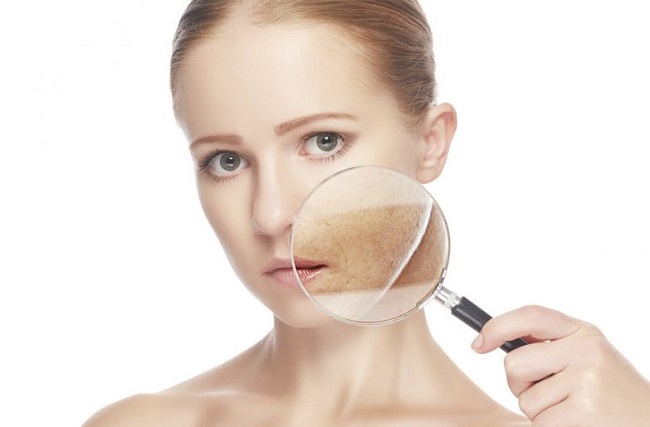 Trị nám tuổi trung niên bằng công nghệ mới tại Midu Spa