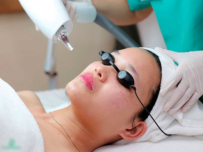 Trị nám tuổi trung niên bằng công nghệ mới tại Midu Spa