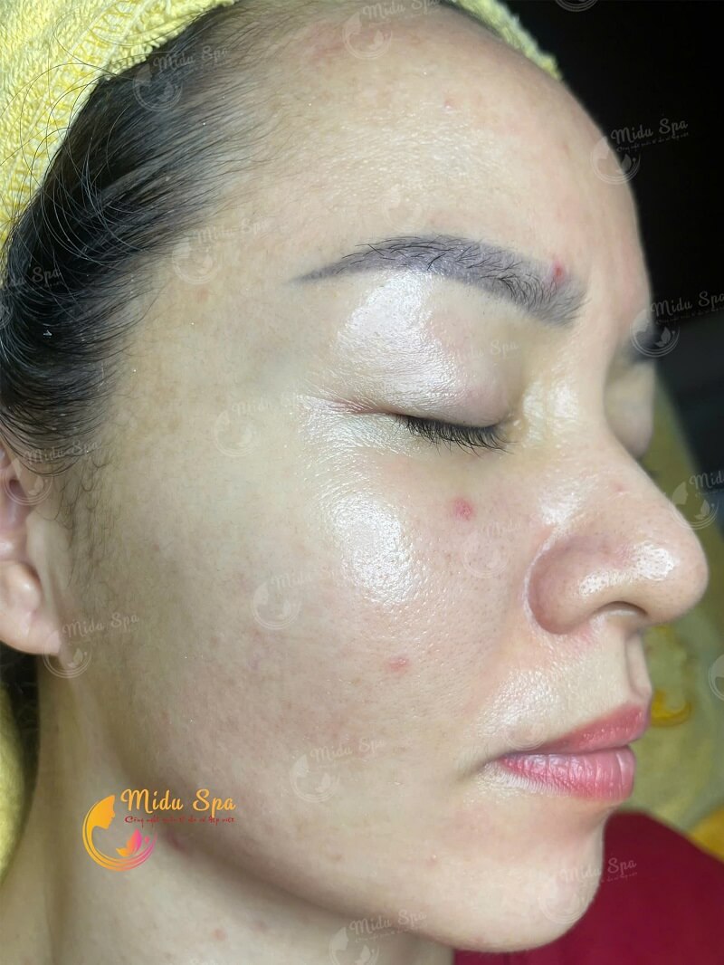 Ưu điểm công nghiệm Ultralight
